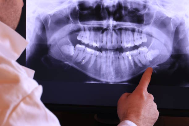 Best Walk-In Emergency Dentist in Mamou, LA