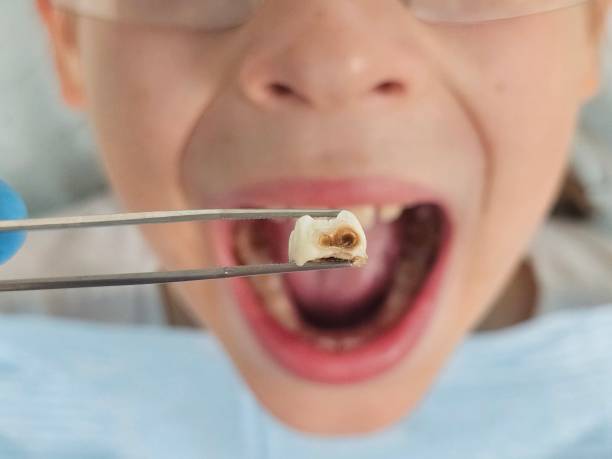 Best After-Hours Emergency Dentist in Mamou, LA